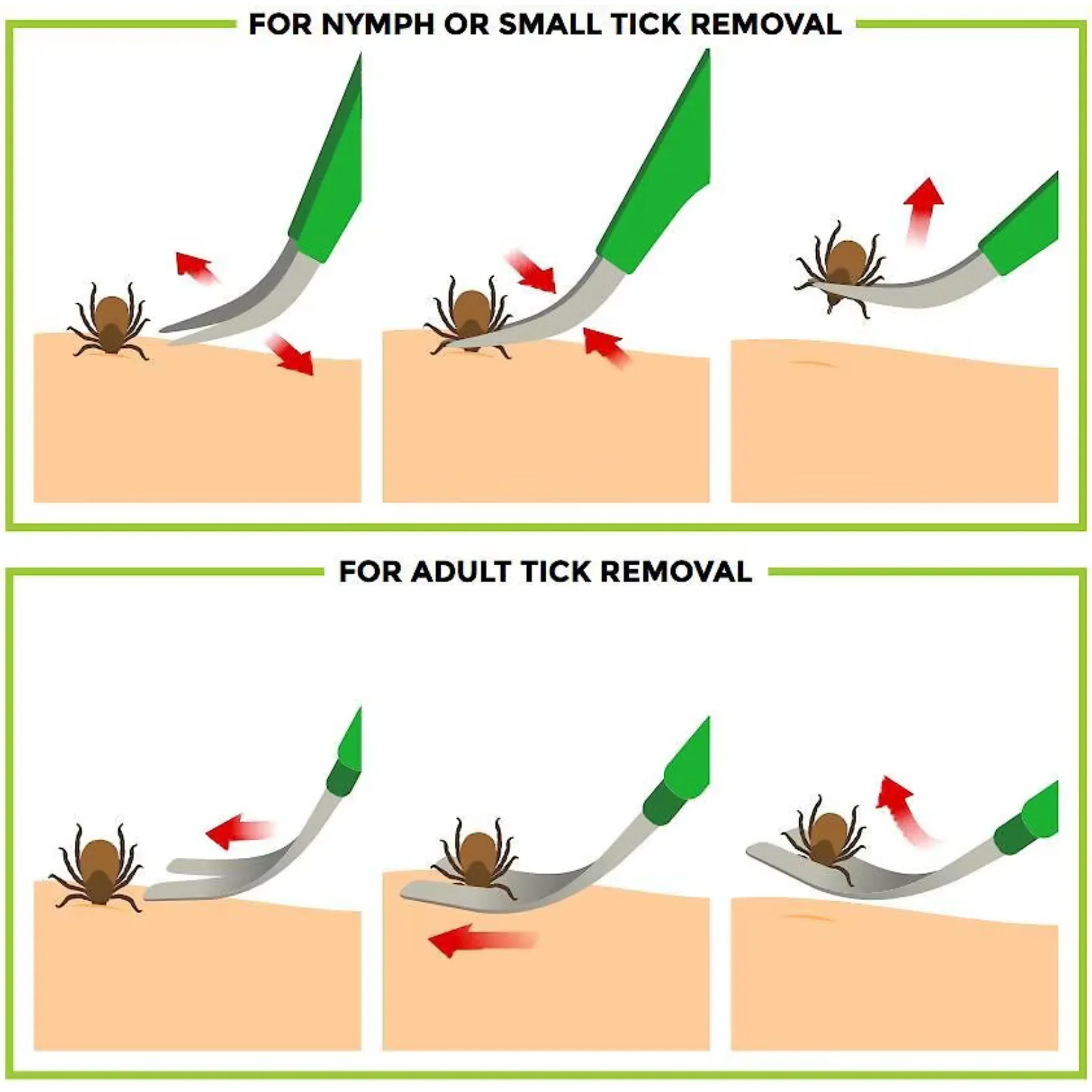 TickCheck Premium Tick Remover Set - Image 4
